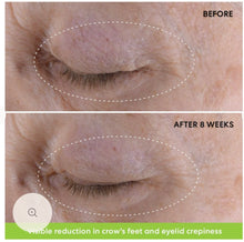 Indlæs billede til gallerivisning Ageless Phyto-Retinol Eye Cream 15 g